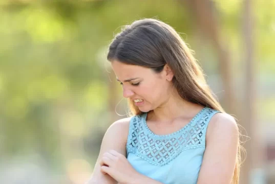 Piqûres d’insectes : méthodes efficaces pour soulager les démangeaisons et les gonflements Piqûres d'insectes : méthodes efficaces pour soulager les démangeaisons et les gonflements